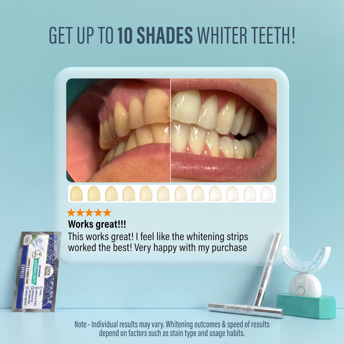 AuraLab professional teeth whitening wireless kit with LED mouth tray and whitening gel for brighter smile.